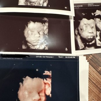3DBabyVu - Ultrasound Imaging Centers Near Me - Pleasanton, California 3DBabyVu - Ultrasound Imaging Centers Near Me - Pleasanton, California