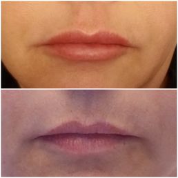 Very happy with the results. Very happy with the results.