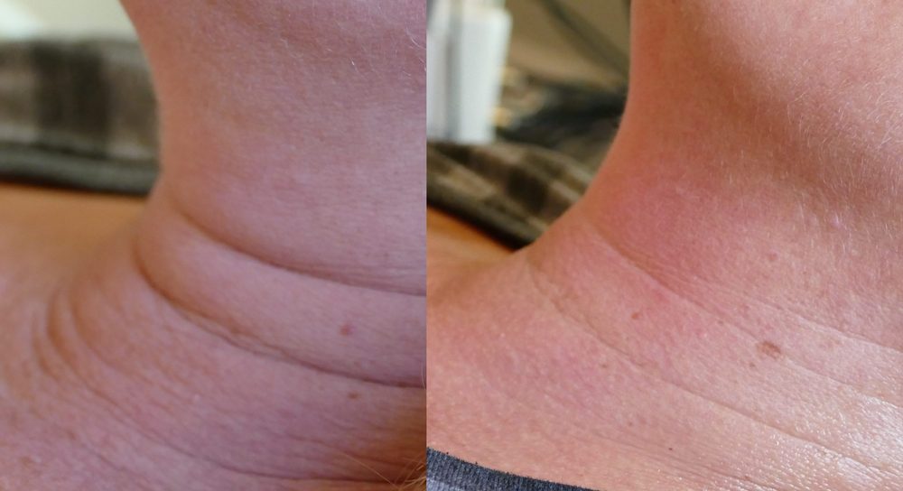 SIMPLY SCULPTED BY BODY FRAME Updated September 2024 25 Photos