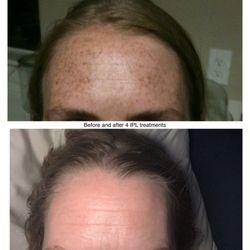 About Face & Skin