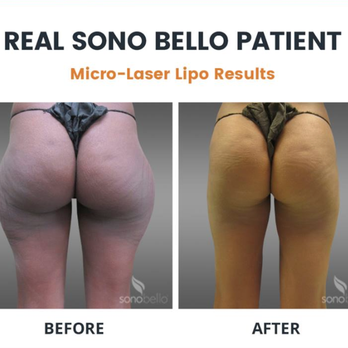 Sono Bello - Cosmetic Surgeons Near Me - Winter Park, Florida Sono Bello - Cosmetic Surgeons Near Me - Winter Park, Florida