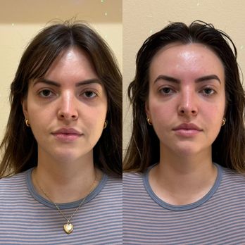 Matryoshka Spa - Buccal / TMJ therapy - Skin Care Near Me - North Hollywood, California Matryoshka Spa - Buccal / TMJ therapy - Skin Care Near Me - North Hollywood, California