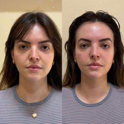 Matryoshka Spa - Buccal / TMJ therapy