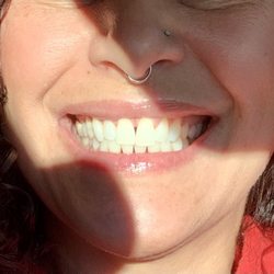 Dental Town - Gleaming and beaming teeth cleaning!