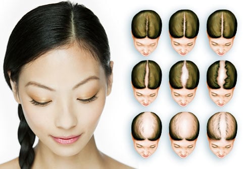 Pizarro Hair Restoration Logo