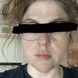 Maffi Plastic Surgery - Face results