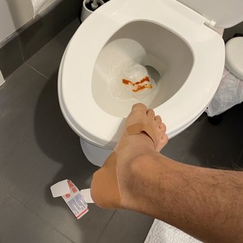 EVIVA on Cherokee - Right foot injury from shattered mirror pieces. - Apartments Near Me - Denver, Colorado EVIVA on Cherokee - Right foot injury from shattered mirror pieces. - Apartments Near Me - Denver, Colorado