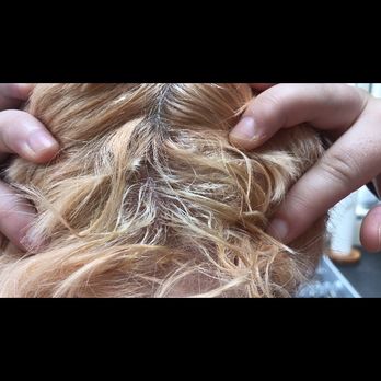 Alan Keville for Hair - Chemical burn and popped blisters with oozing from scalp - Hair Salons Near Me - Dublin, D Alan Keville for Hair - Chemical burn and popped blisters with oozing from scalp - Hair Salons Near Me - Dublin, D