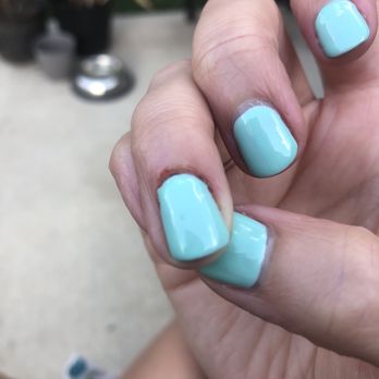 Britney Nails & Spa - After some home clean-up and first aid. Cuticle is totally gone. - Nail Salons Near Me - Indianapolis, Indiana