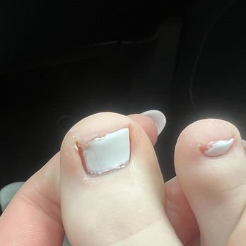 Eco Nails - again toenail half painted ( ignore my ugly toes) - Waxing Near Me - St. Louis, Missouri Eco Nails - again toenail half painted ( ignore my ugly toes) - Waxing Near Me - St. Louis, Missouri
