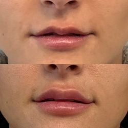 Clinique Derma MD