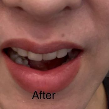 Bright Braces - Orthodontist in Katy - After all the time, money, and trust -- this was not what I expected. - Orthodontists Near Me - Katy, Texas Bright Braces - Orthodontist in Katy - After all the time, money, and trust -- this was not what I expected. - Orthodontists Near Me - Katy, Texas