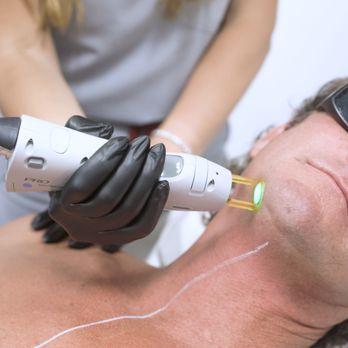 Austin Laser Solutions - Candela GentlePro Max: safe & effective laser hair removal for all skin types. Say goodbye to unwanted hair on the chin! - Laser Hair Removal Near Me - Sunset Valley, Texas