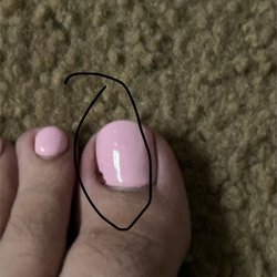 Oscar Nails & Spa - My Toe is Swollen and bleeding
