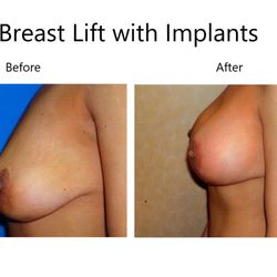 Rosenfeld Plastic Surgery