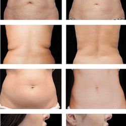 Toxic Beauty - Body sculpting