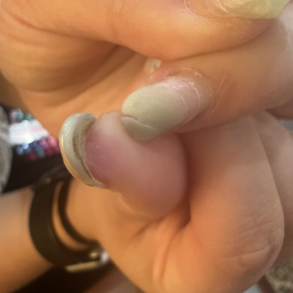 Dream Nails - cutting too far down into natural nail and acrylic and skin - Nail Salons Near Me - Vancouver, Washington Dream Nails - cutting too far down into natural nail and acrylic and skin - Nail Salons Near Me - Vancouver, Washington