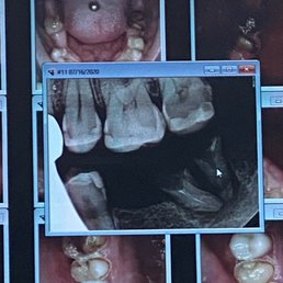 Dental rad and pictures