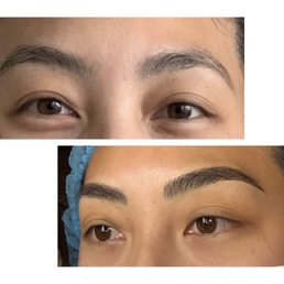 My before and after My before and after