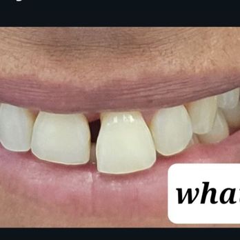 OraBell Dental Implant Centers - Cosmetic Dentists Near Me - Van Nuys, California OraBell Dental Implant Centers - Cosmetic Dentists Near Me - Van Nuys, California