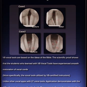 Voice In The Beginning - Vocal cord and larynx Before&After Medically certified - Musical Instruments & Teachers Near Me Voice In The Beginning - Vocal cord and larynx Before&After Medically certified - Musical Instruments & Teachers Near Me