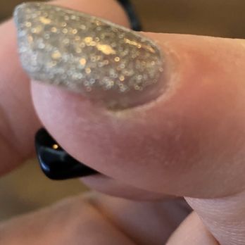 Trinity Nails Spa - Beginning of infection - Nail Salons Near Me - Littleton, Colorado