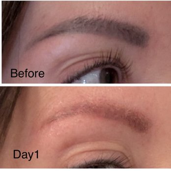 Removery Tattoo Removal & Fading - After just one session - Tattoo Removal Near Me - Henderson, Nevada Removery Tattoo Removal & Fading - After just one session - Tattoo Removal Near Me - Henderson, Nevada