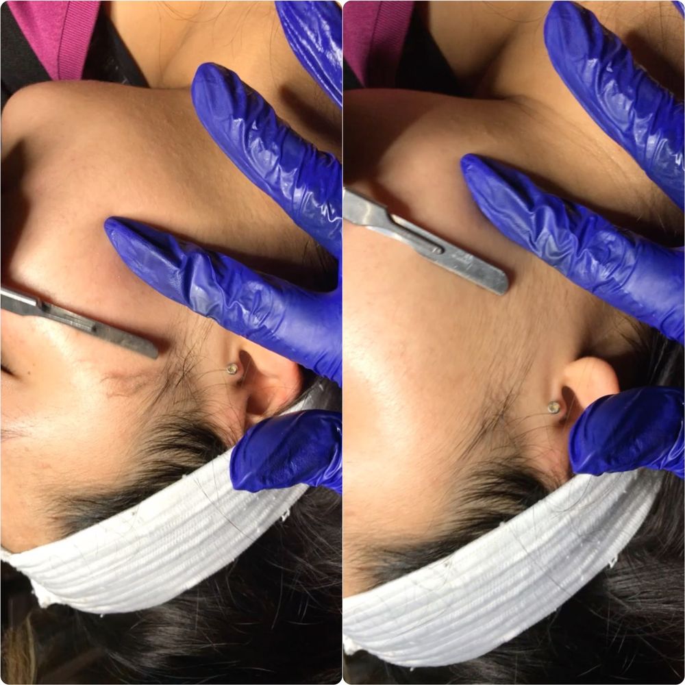 Innovation Skin care Logo