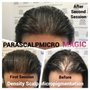Photo of Parascalpmicro