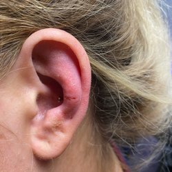 Hard Knox Tattoo - After I had their hoop removed