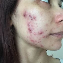 Glow Advanced Skin and Body Care - November 2017