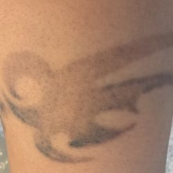 Free & Clear Skin - After 4 sessions, this tribal arm band show significant fading.