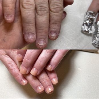 Rose Nails Spa - Looks at this transformation - Nail Salons Near Me - Frederick, Maryland Rose Nails Spa - Looks at this transformation - Nail Salons Near Me - Frederick, Maryland