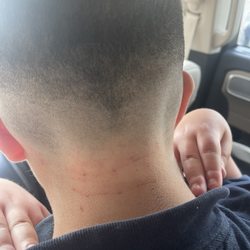 Alex Barber Shop - Neck and both ears full of cuts