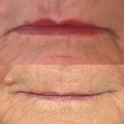Brow Baby Blading - Healed lip blush