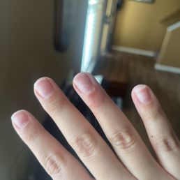 Missing cuticle on ring finger