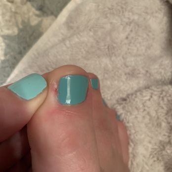 Dylan Blue Nail Spa - Costa Mesa - They cut off the side of my toenail down to skin - Nail Salons Near Me - Costa Mesa, California Dylan Blue Nail Spa - Costa Mesa - They cut off the side of my toenail down to skin - Nail Salons Near Me - Costa Mesa, California