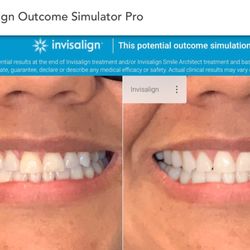Van Oaks Family Dental Practice - Invisalign consultations available.