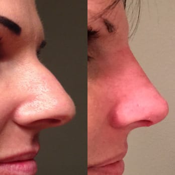 Adam Weinfeld, MD - Perfection. - Cosmetic Surgeons Near Me - Austin, Texas
