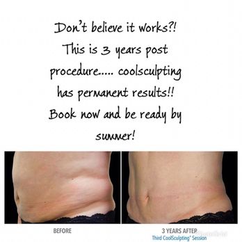 Moran Laser And Salon - CoolSculpting promotion! - Tattoo Removal Near Me - Nashville, Tennessee Moran Laser And Salon - CoolSculpting promotion! - Tattoo Removal Near Me - Nashville, Tennessee