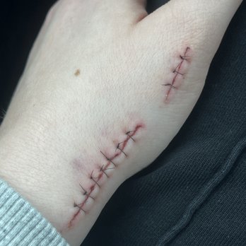 Borgess Emergency Trauma and Immediate Care - They wouldn't even look at my cut, I didn't get past the waiting room. - Hospitals Near Me - Portage, Michigan Borgess Emergency Trauma and Immediate Care - They wouldn't even look at my cut, I didn't get past the waiting room. - Hospitals Near Me - Portage, Michigan