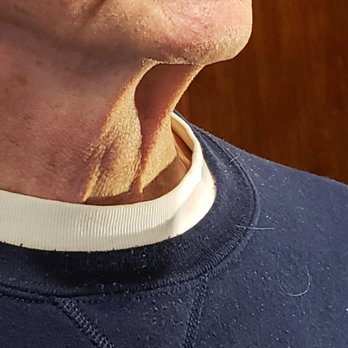 Foley Plastic Surgery Center - $9500+ down the drain. Dr. Foley disclaims responsibility to correct. - Cosmetic Surgeons Near Me - Olympia, Washington