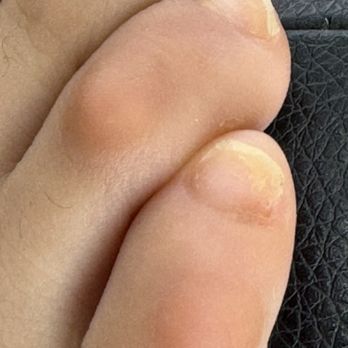 Club Nails - DAMAGED TOE NAILS - Nail Salons Near Me - Laguna Niguel, California