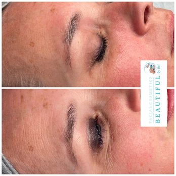 Beautiful By Bri - Green tea facial - Medical Spas Near Me - Beverly, Massachusetts Beautiful By Bri - Green tea facial - Medical Spas Near Me - Beverly, Massachusetts