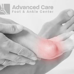 Advanced Care Foot & Ankle Center - Bunion pain? If left untreated, it can lead to further complications.