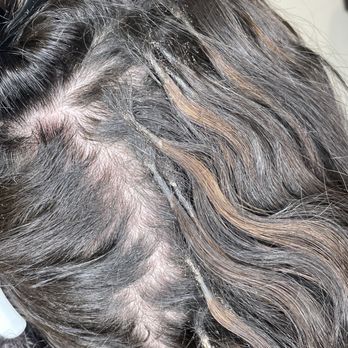 Noelle Salon & Spa - Broken hair follicles - Hair Loss Centers Near Me - Melrose, Massachusetts