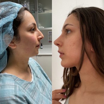Rady Rahban, MD - I LOVE MY SIDE PROFILE! - Cosmetic Surgeons Near Me - Beverly Hills, California Rady Rahban, MD - I LOVE MY SIDE PROFILE! - Cosmetic Surgeons Near Me - Beverly Hills, California