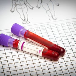 Naturopathic Physician can perform annual physicals for school or work and order blood tests and laboratory tests as necessary.