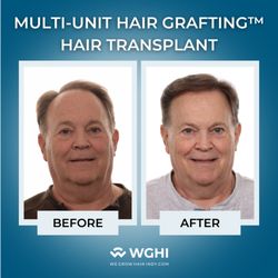 We Grow Hair Indy