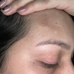 North Coast Plastic Surgery - Incision site